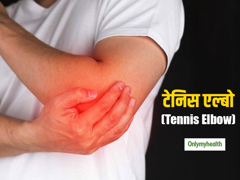 आप जानते हैं टेनिस एल्बो क्या है? जानें इसके प्राकृृतिक उपचार के लिए 5 घरेलू उपाय